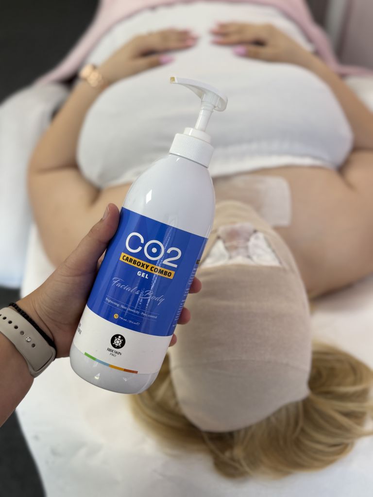 CO2 Carboxy Combo kezelés Tatabányán – Oxigénes bőrmegújítás - Beauty Shape